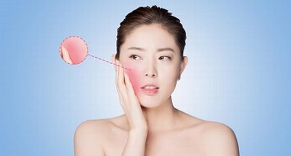 敏家：擺激素臉反復糾纏 你必須要有清晰的認知