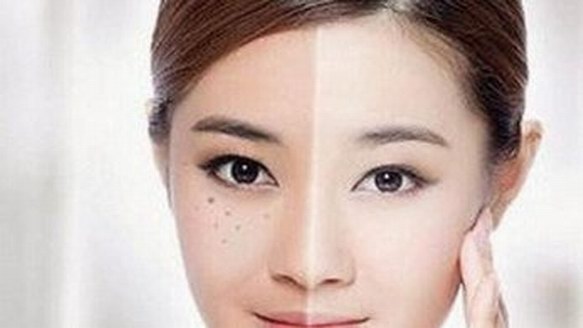 春語蜂巢皮秒，肌膚注定不一“斑”