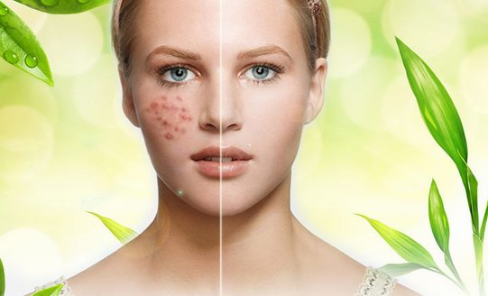 遇到這款平價祛痘神器，SK-II、奧爾濱全部靠邊站
