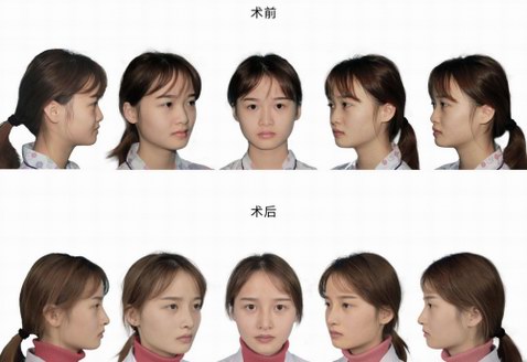 超體x新氧x100家機構全國招募美鼻體驗官第二季