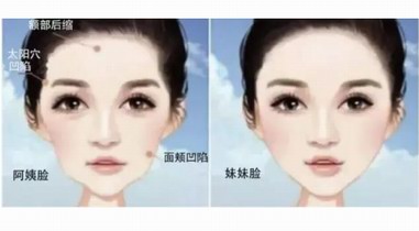  家恩德仁：整形醫生提醒您，關于脂肪填充這些事不可不知