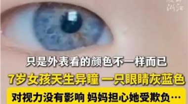 江西7歲女孩天生異瞳受到同學喜愛，醫生：出現這些情況應及時治療