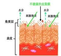 vinistyle教你掌控敏感肌，不做嬌氣“瓷娃娃”